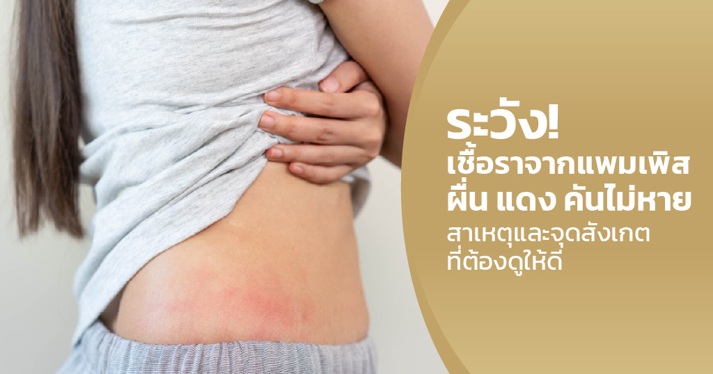 เชื้อราจากแพมเพิส