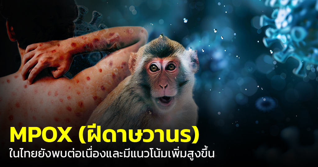 agewell อัปเดต Mpox ไทยปี 2569